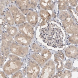 MPRIP Antibody, Novus Biologicals 25ul | Buy Online | Novus Biologicals | Fisher Scientific